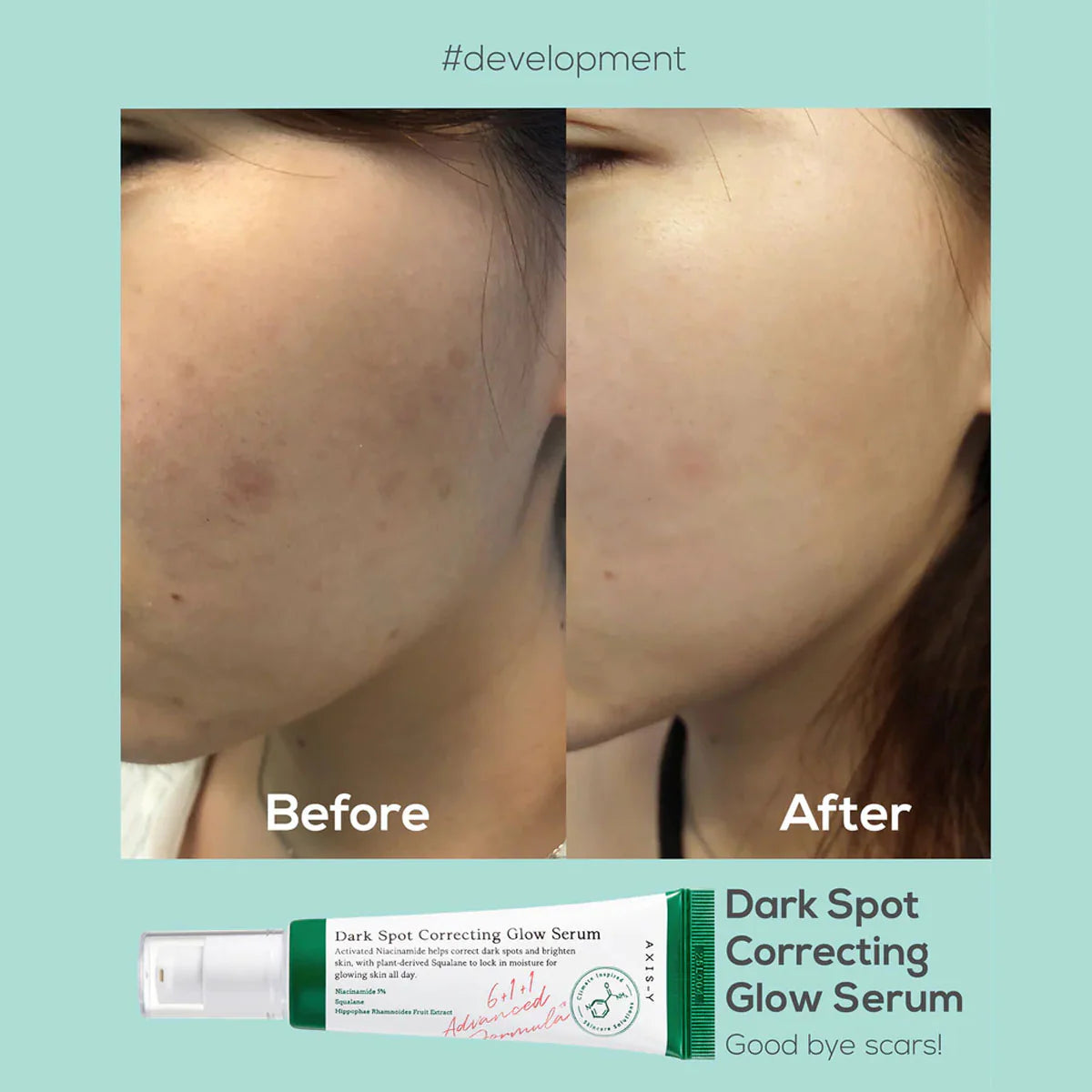 AXIS-Y-Dark Spot Correcting Glow Serum 100% Original