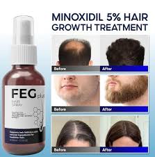 FEG Hair Growth Solution ,For Men and Women